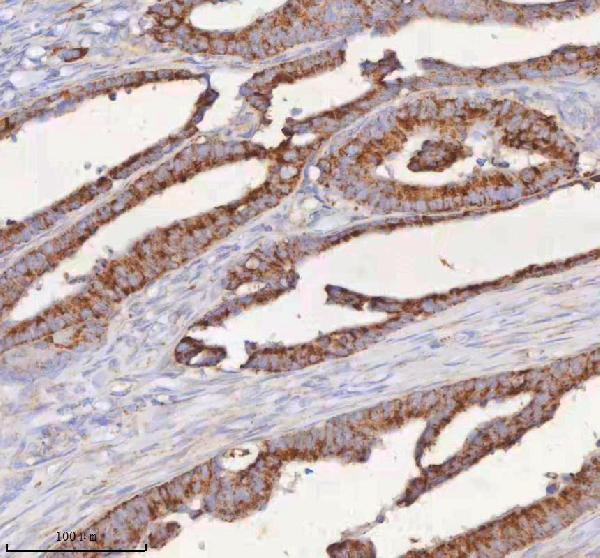 a09824 1 slc6a20 primary antibodies ihc testing 11