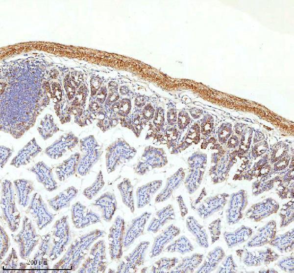 a09824 1 slc6a20 primary antibodies ihc testing 12