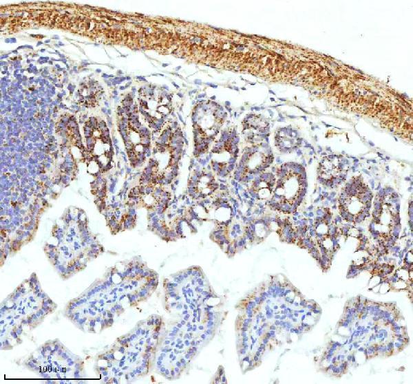 a09824 1 slc6a20 primary antibodies ihc testing 13