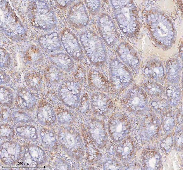 a09824 1 slc6a20 primary antibodies ihc testing 2