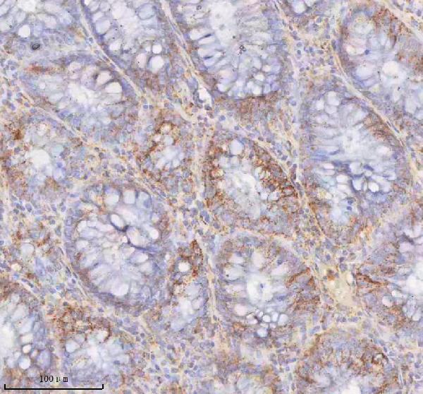 a09824 1 slc6a20 primary antibodies ihc testing 3