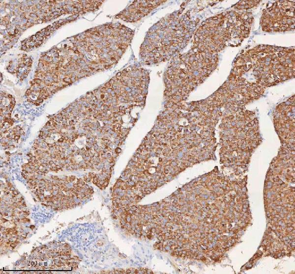 a09824 1 slc6a20 primary antibodies ihc testing 4