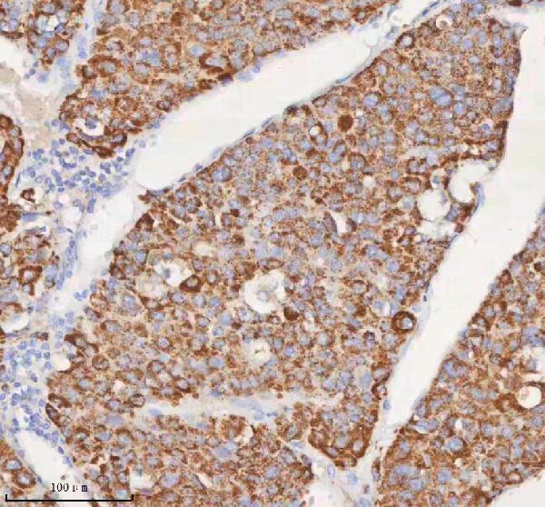 a09824 1 slc6a20 primary antibodies ihc testing 5