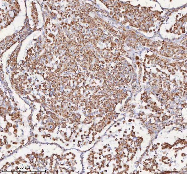 a09824 1 slc6a20 primary antibodies ihc testing 6