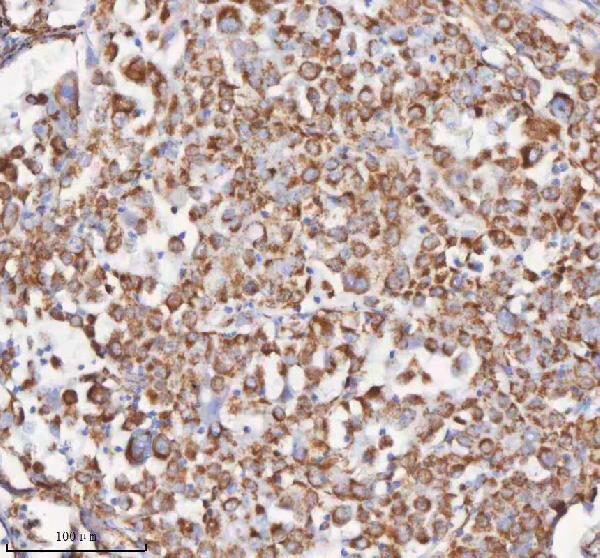a09824 1 slc6a20 primary antibodies ihc testing 7