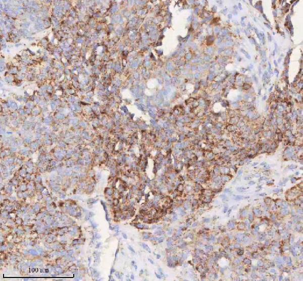 a09824 1 slc6a20 primary antibodies ihc testing 9