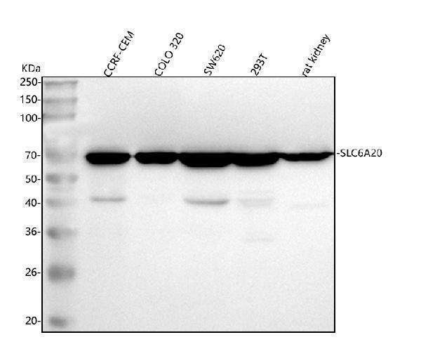 a09824 1 slc6a20 primary antibodies wb testing 1