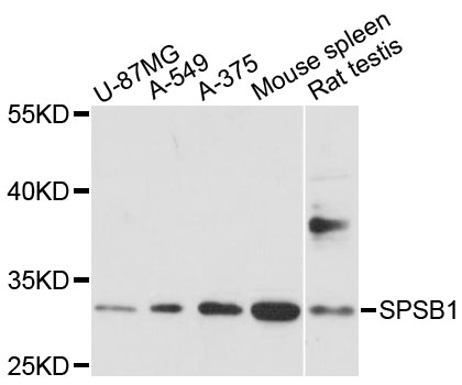 Western blot analysis of extracts of various cell lines, using SPSB1 antibody at 1:1000 dilution
