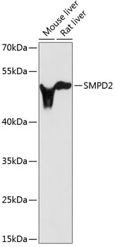 Western blot analysis of extracts of various cell lines, using SMPD2 antibody  at 1:3000 dilution