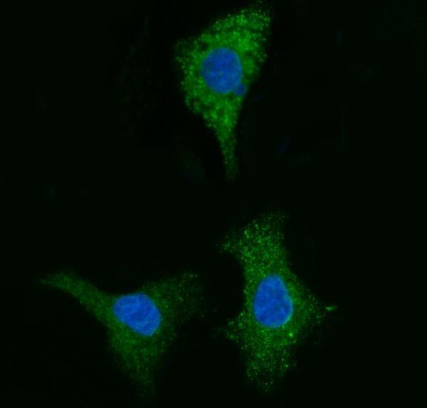 a09841 1 cyb5b primary antibodies if testing 7