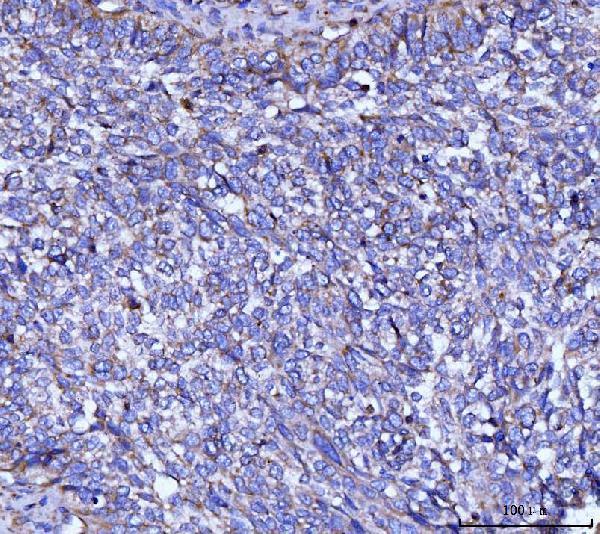 IHC analysis of CYB5B using anti-CYB5B antibody (A09841-1)