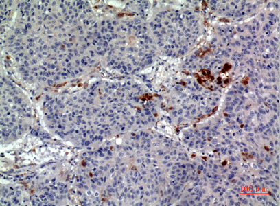 a09845 cd163l1 primary antibodies ihc testing 1