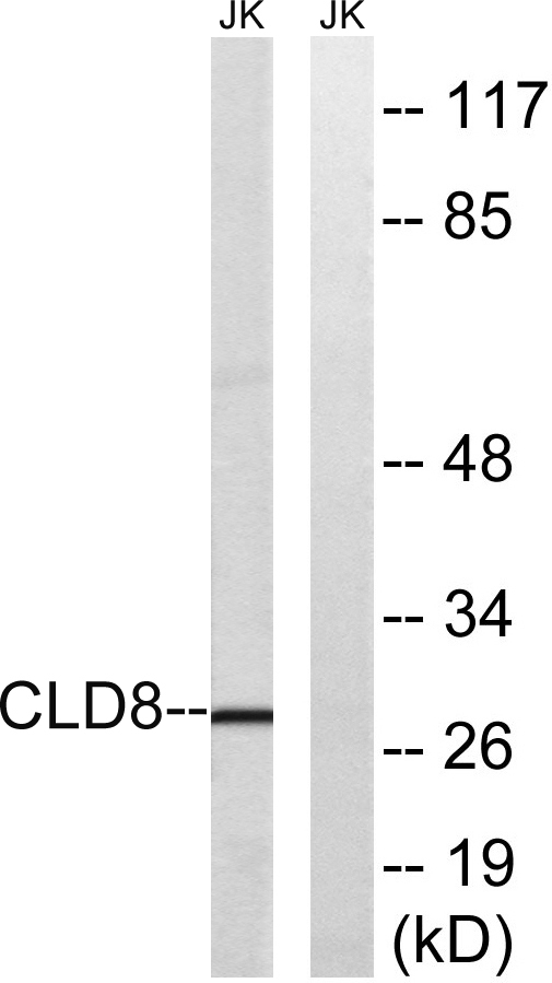 Western blot analysis of lysates from Jurkat cells, using CLDN8 Antibody