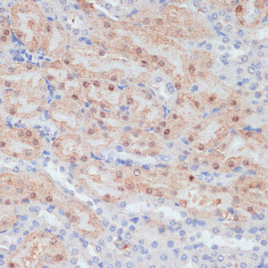 Immunohistochemistry of paraffin-embedded mouse kidney using CLDN17 antibody  at dilution of 1:100 