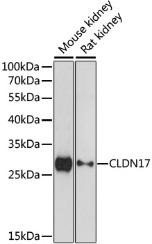 Western blot analysis of extracts of various cell lines, using CLDN17 antibody  at 1:1000 dilution