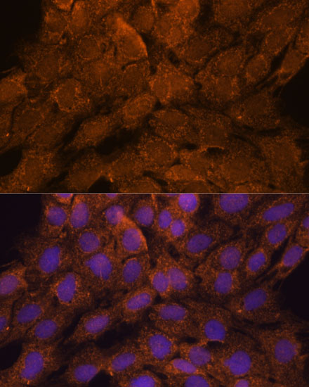 a09847 1 tnfaip8l2 primary antiboties if testing 2