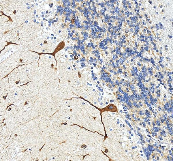 a09852 2 toe1 primary antibodies ihc testing 1