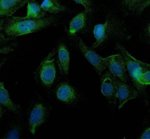 a09853 2 ythdf1 primary antibodies if testing 1