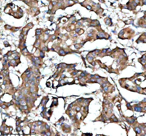 a09853 2 ythdf1 primary antibodies ihc testing 1
