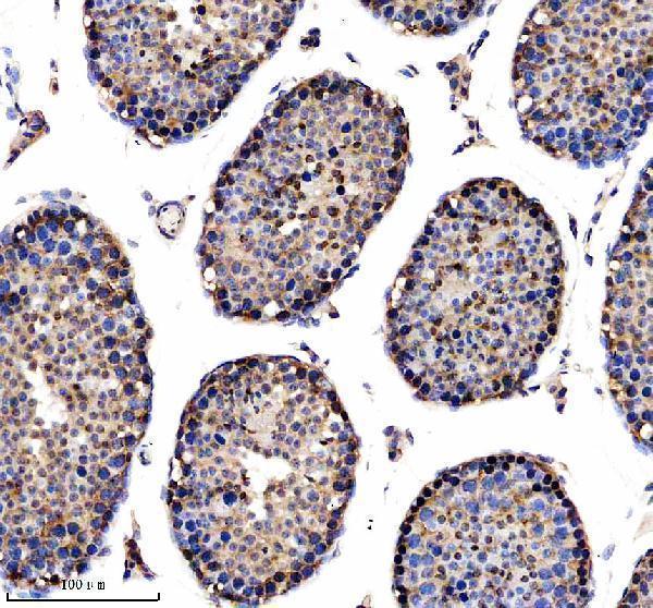 IHC analysis of YTHDF1 using anti-YTHDF1 antibody (A09853-2)