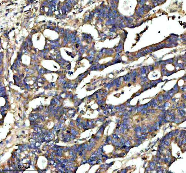 a09853 2 ythdf1 primary antibodies ihc testing 2_1
