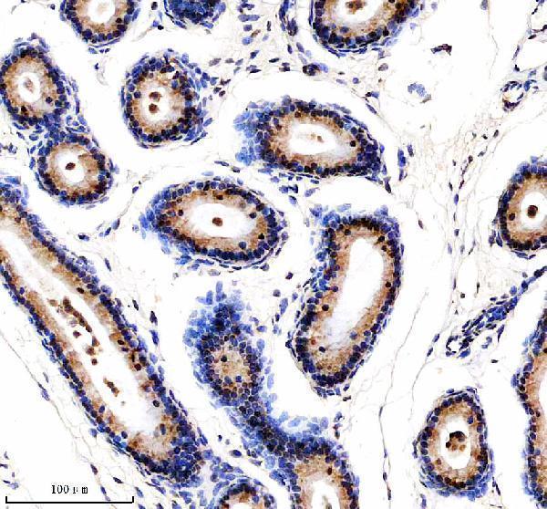  IHC analysis of YTHDF1 using anti-YTHDF1 antibody (A09853-2)