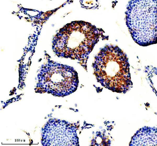 a09853 2 ythdf1 primary antibodies ihc testing 3_1