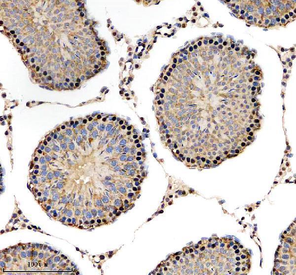 a09853 2 ythdf1 primary antibodies ihc testing 4