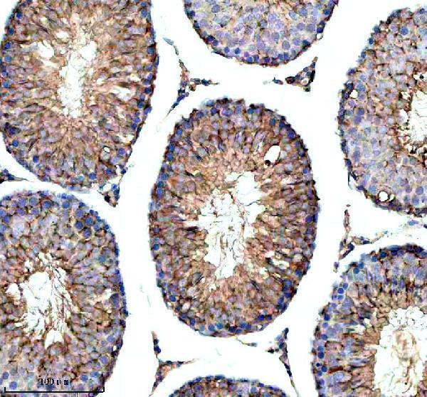 a09853 2 ythdf1 primary antibodies ihc testing 4_1