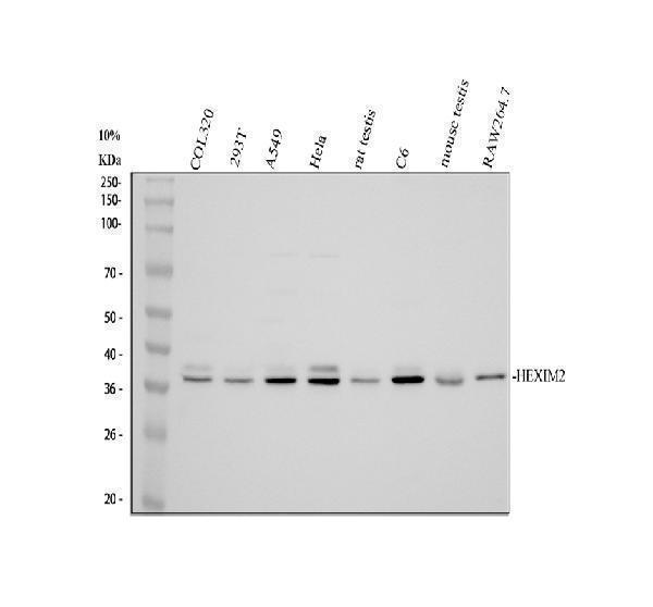 Western blot analysis of HEXIM2 using anti-HEXIM2 antibody (A09854-2)