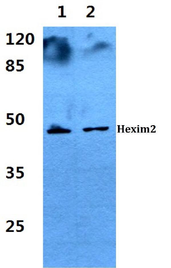 Western blot (WB) analysis of Hexim2 polyclonal antibody at 1:500 dilution
Lane1:HEK293T cell lysate
Lane2:A549 cell lysate