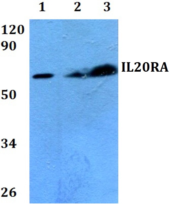 a09859 1 il20ra primary antiboties wb testing 1