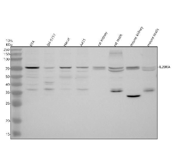 a09859 2 il20ra primary antibodies wb testing 1