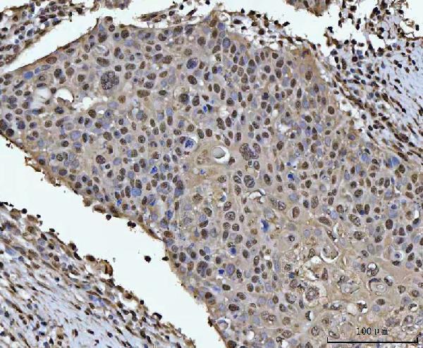  IHC analysis of HOXC4 using anti-HOXC4 antibody (A09869-1)