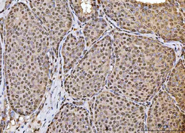  IHC analysis of HOXC4 using anti-HOXC4 antibody (A09869-1)