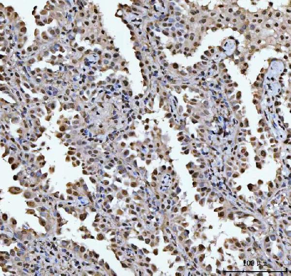 a09869 1 hoxc4 primary antibodies ihc testing 4