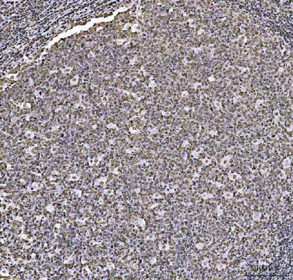 a09869 1 hoxc4 primary antibodies ihc testing 5