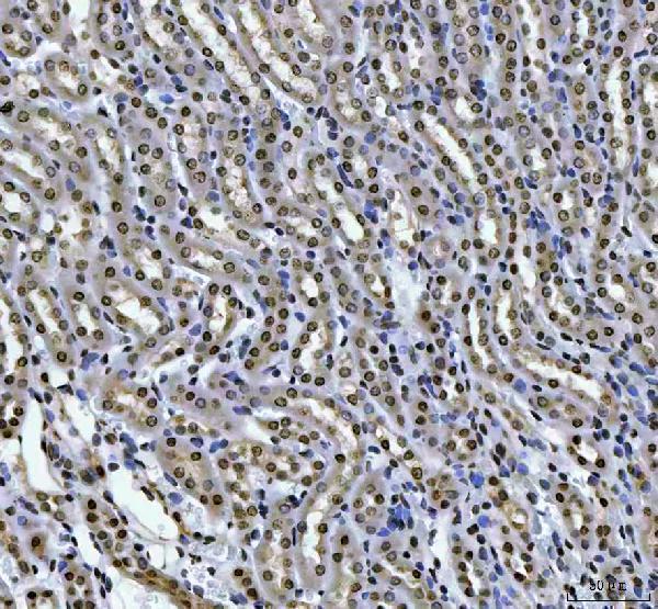 a09869 1 hoxc4 primary antibodies ihc testing 6