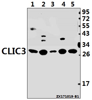 Western blot (WB) analysis of CLIC3 (F56) pAb at 1:500 dilution
Lane1:3T3-L1 whole cell lysate(40ug)
Lane2:PC12 whole cell lysate(40ug)
Lane3:HCC827 whole cell lysate(40ug)
Lane4:HEK293T whole cell lysate(40ug)
Lane5:H1792 whole cell lysate(40ug)