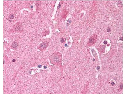 Boster's Affinity Purified anti-LDB2 (Clim1) antibody was used at a 5 µg/ml to detect LDB2 in human brain cortex tissue