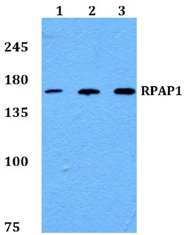 Western blot (WB) analysis of RPAP1 polyclonal antibody at 1:500 dilution
Lane1:HEK293T whole cell lysate
Lane2:NIH-3T3 whole cell lysate
Lane3:H9C2 whole cell lysate