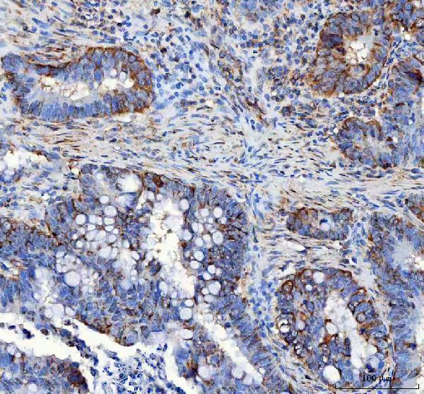 a09874 2 lrrc59 primary antibodies ihc testing 3