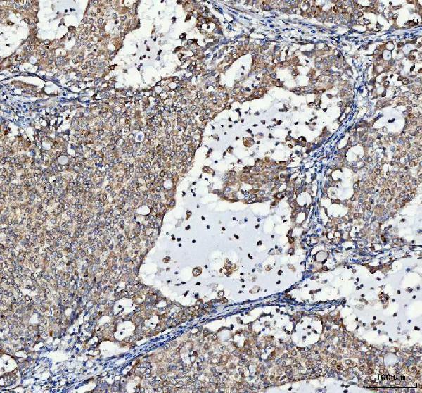 a09874 2 lrrc59 primary antibodies ihc testing 4