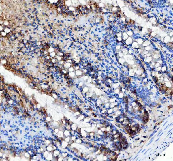 a09874 2 lrrc59 primary antibodies ihc testing 7