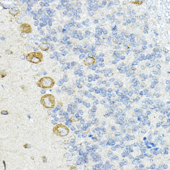 a09874 lrrc59 primary antiboties ihc testing 2
