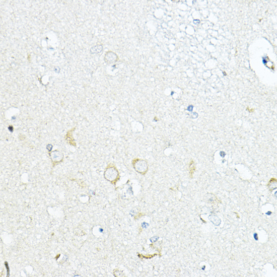 a09874 lrrc59 primary antiboties ihc testing 3