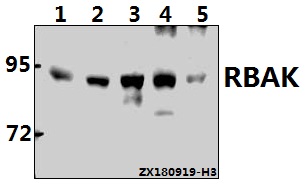 Western blot (WB) analysis of RBAK (W22) polyclonal antibody at 1:500 dilution
Lane1:L02 whole cell lysate(40ug)
Lane2:H1792 whole cell lysate(40ug)
Lane3:HEK293T whole cell lysate(40ug)
Lane4:PC12 whole cell lysate(40ug)
Lane5:AML-12 whole cell lysate(40ug)
