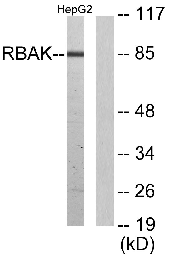 Western blot analysis of lysates from HepG2 cells, using RBAK Antibody