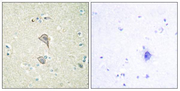 a09881 nktr primary antibodies ihc testing 2