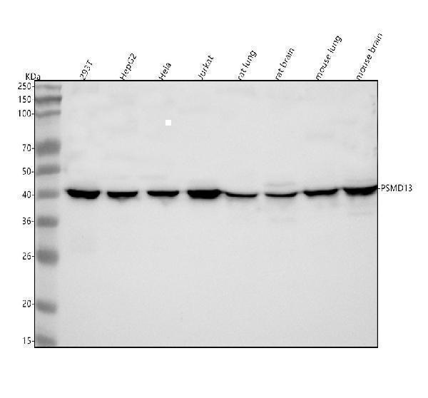  Western blot analysis of PSMD13 using anti-PSMD13 antibody (A09882-1)